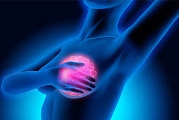 Que faire pour réduire le risque du cancer du sein?