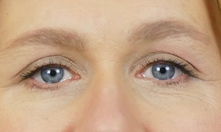 5 remèdes naturels pour éliminer les paupières tombantes : Exercices oculaires